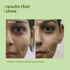 Green Tea Face Wash for Acne & Oily Skin | 1% Salicylic Acid | Deep Cleansing Face Cleanser | Oil Control | 100ml